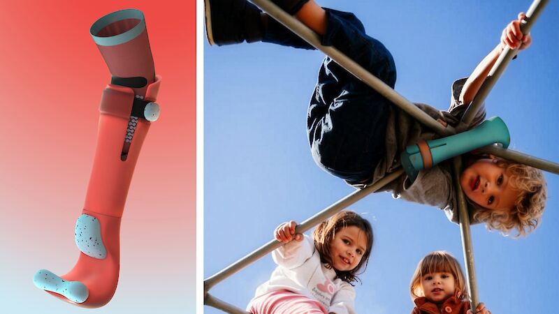 Kinderprothese bei Dysmelie – «Yumi» von Janis Mayer, Simon Haas und Trisha Wettstein