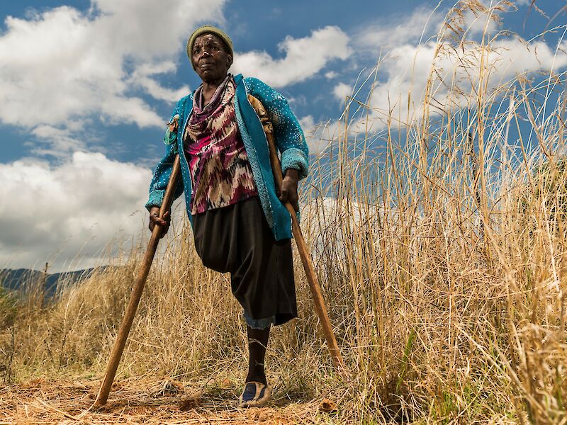Long Limbs Prosthetics - An Interchangeable Prosthetic System for Long Stump Amputees