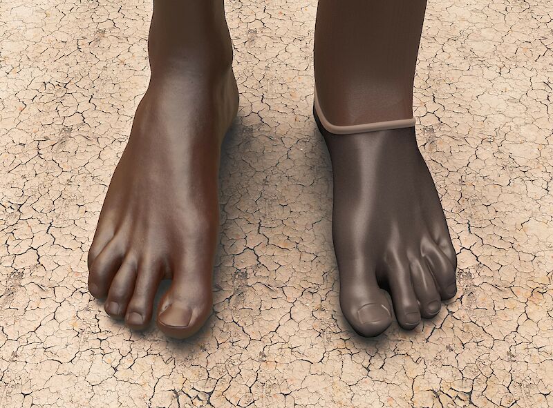 Long Limbs Prosthetic System in Context. Render. Long–Limbs ©.