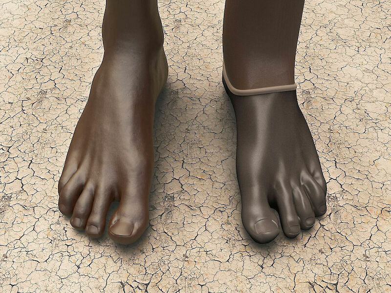 Long Limbs Prosthetics