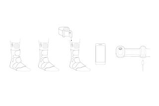 Schmerzpatient:innen können spontan oder gezielt die Controlunit verbinden, um sich zu therapieren.