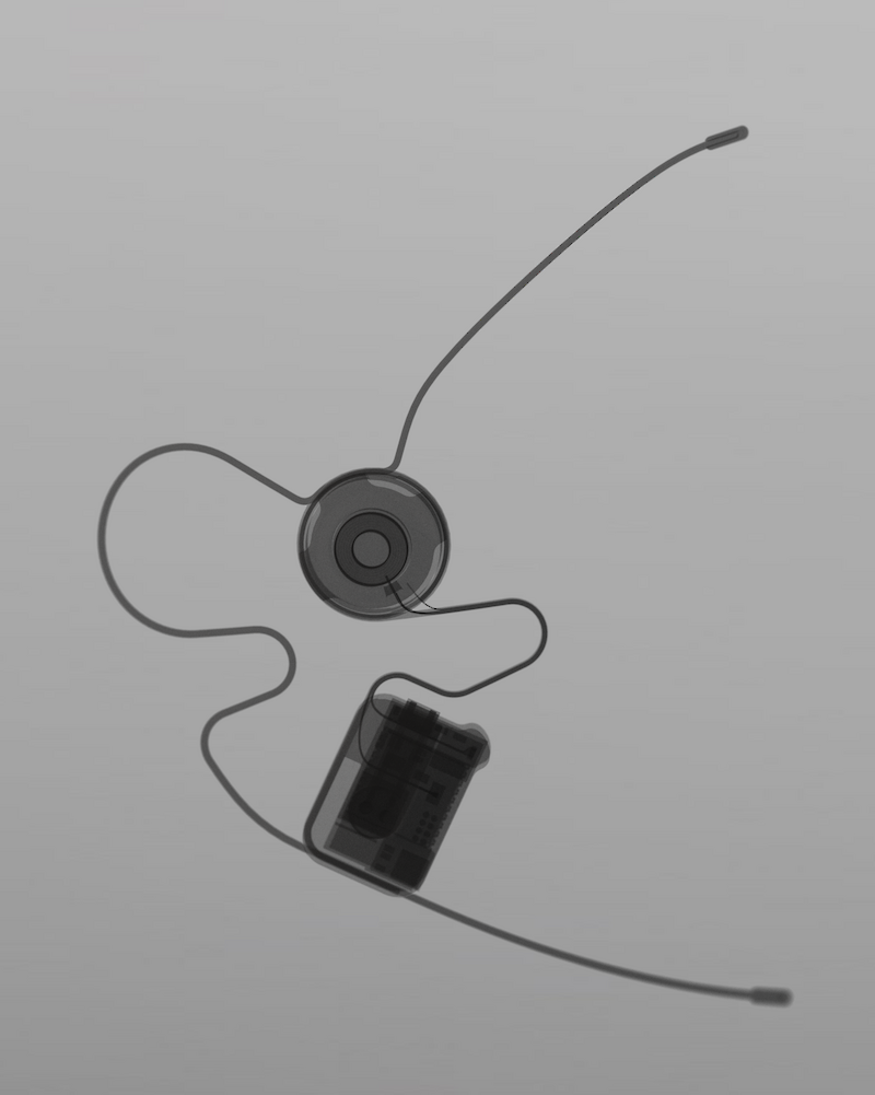 Intraoral Sensing